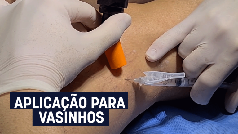Aplicação para Vasinhos